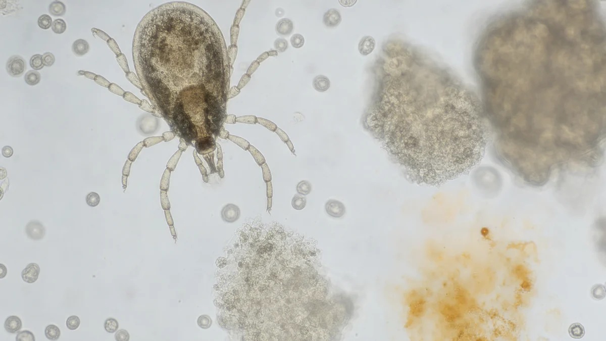 Alpha-Gal Syndrome: The Tick-Borne Red Meat Allergy You May Not Know You Have