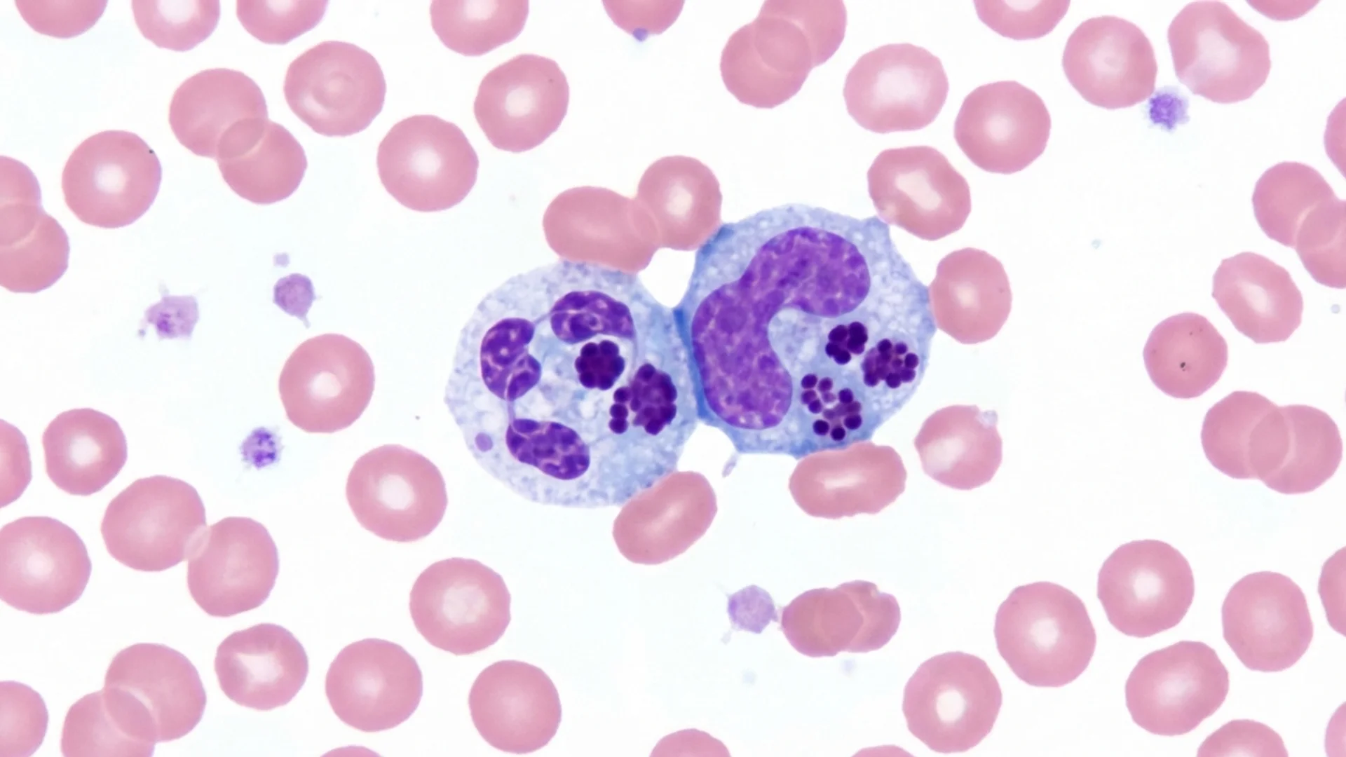 Ehrlichia and Anaplasma