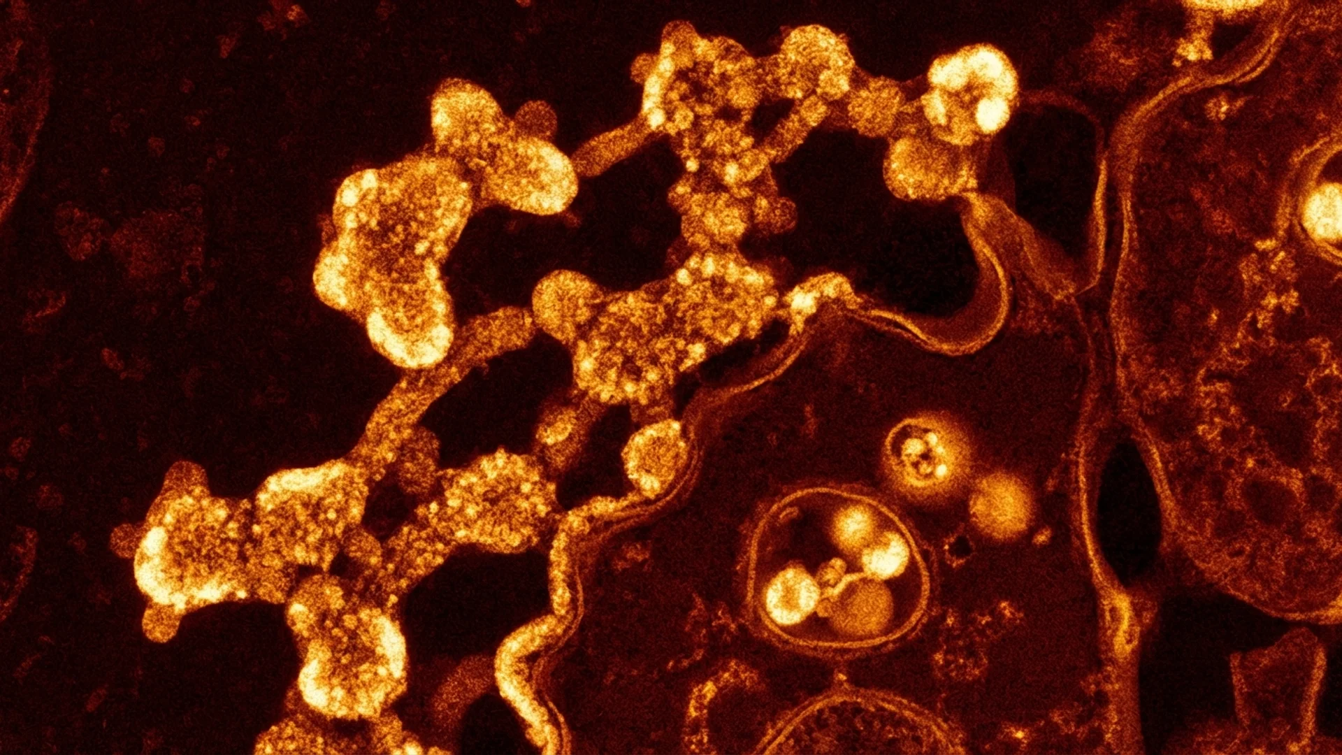 Mycoplasma and Chlamydia Pneumoniae