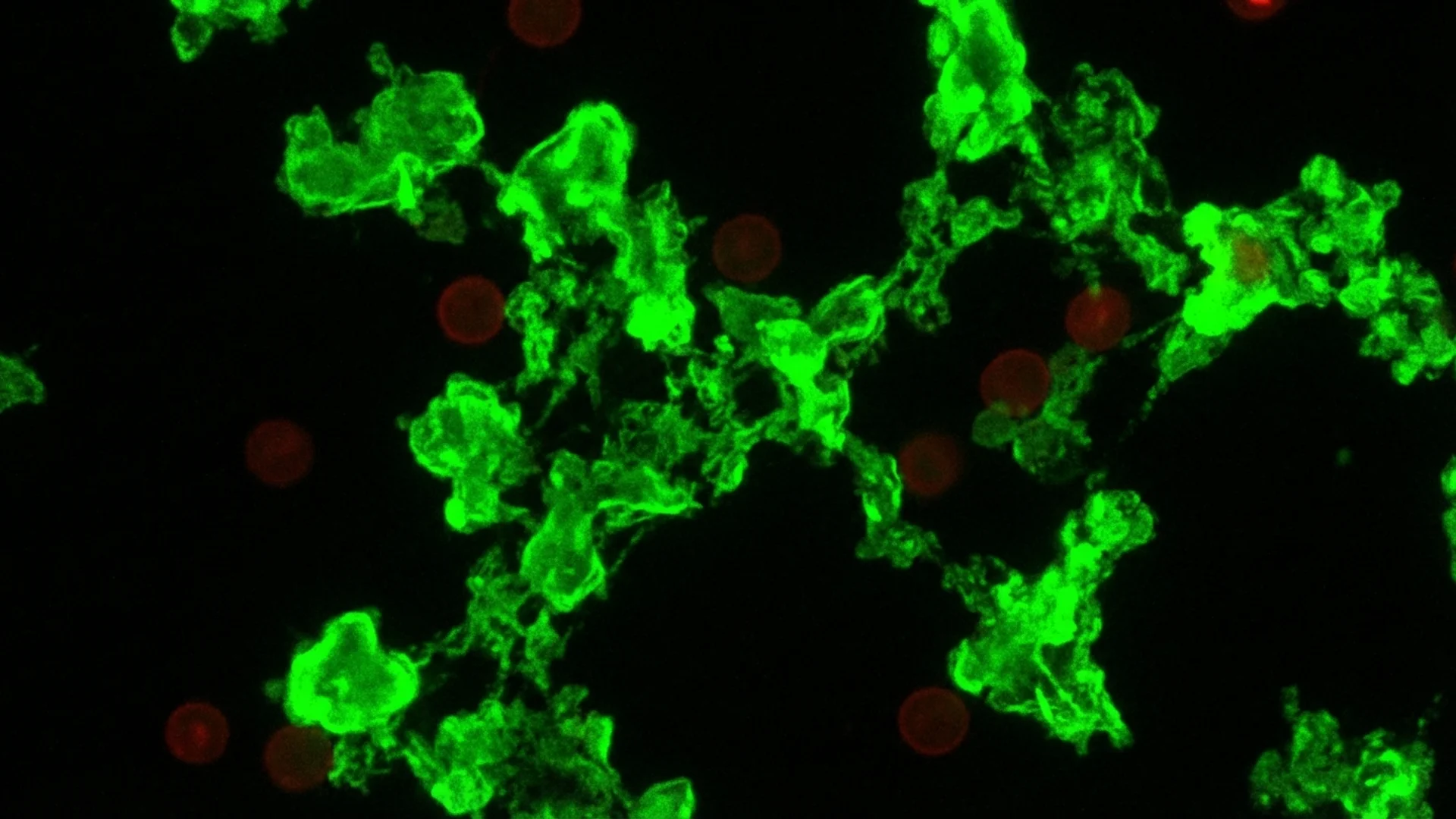 Microclots and Endothelial Dysfunction