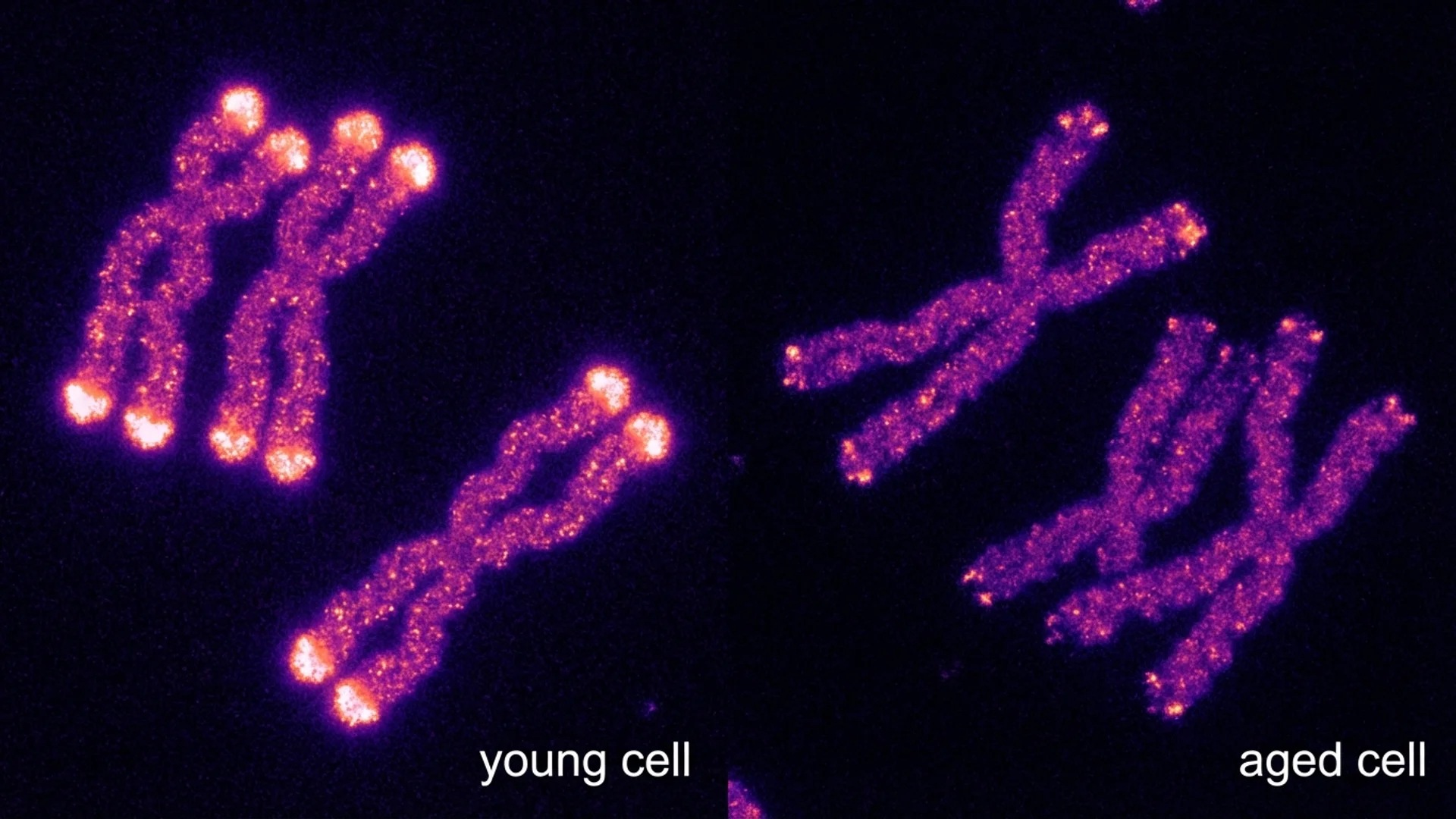 Telomere Health: Length, Telomerase, Epithalon